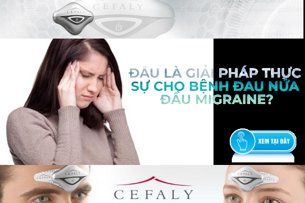 Cefaly giải pháp chữa bệnh đau nửa đầu Migraine