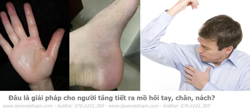 Lavenvietnam cung cấp giải pháp chữa ra mồ hôi tay chân nách hiệu quả