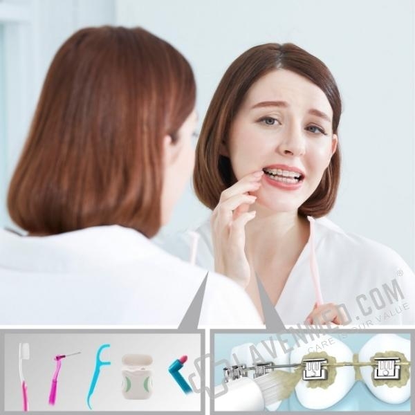 Chăm sóc răng miệng là một việc bất tiện cho bệnh nhân chỉnh nha: