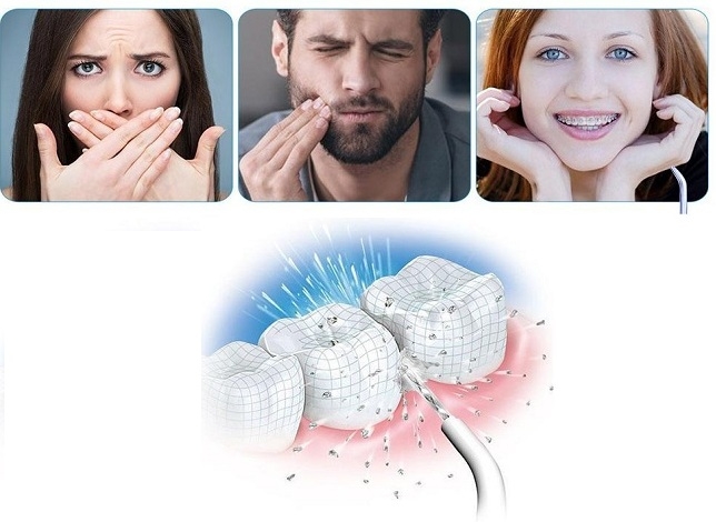 Chăm sóc răng miệng thường xuyên giúp hạn chế được nhiều bệnh tật