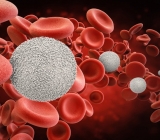 Nguy cơ ung thư từ việc cấy ghép tế bào gốc tạo máu