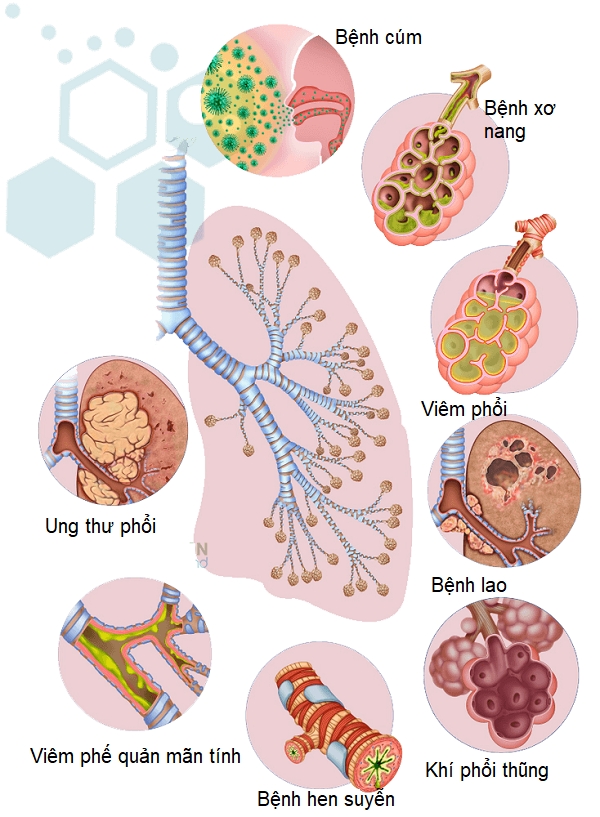 Các chứng bệnh chủ yếu về phổi