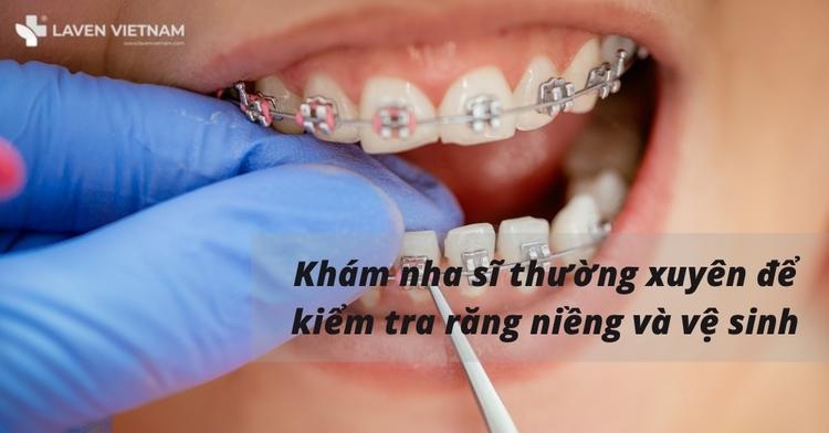 Đi khám nha khoa thường xuyên trong suốt quá trình niềng răng